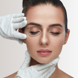 Blefaroplasma