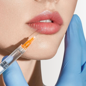 Perfilado y Relleno Labial
